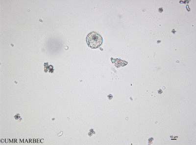 phyto/Bizerte/bizerte_bay/RISCO April 2014/Centrique spp 15-70µm (141216_001_ovl)(copy)_thumb.jpg